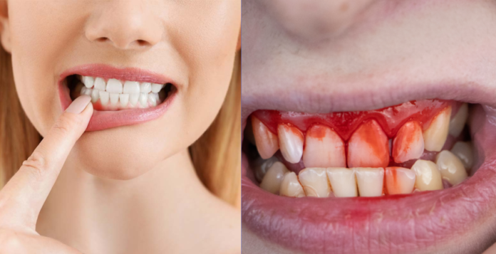 how long do cut gums take to heal